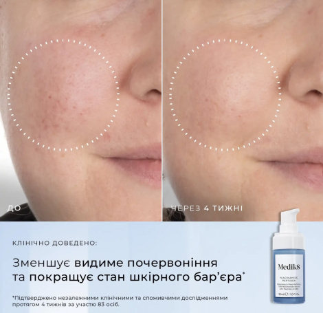 Пептидная сыворотка с 10% ниацинамида для уменьшения высыпаний и сужения пор Medik8 Niacinamide Peptides, 30 мл