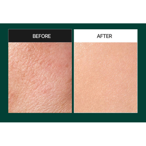 М'яка пілінг-сироватка зі спікулами та центелою MEDI PEEL PHYTO CICA-NOL B5 3000 SHOT SERUM, 50 мл