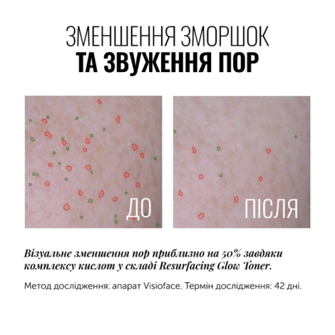 ﻿Тонер с гликолевой кислотой INSTYTUTUM RESURFACING GLOW TONER, 150 мл
