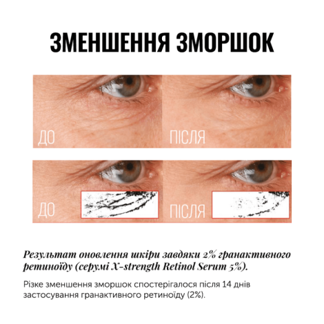 Сироватка з ретиноїдом INSTYTUTUM PRO-GRADE ANTI-AGING X-STRENGTH RETINOL SERUM, 30 мл