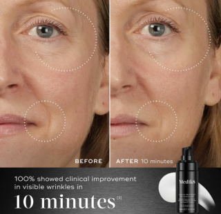 Инновационная сыворотка для борьбы с признаками старения кожи Medik8 Liquid Peptides Advanced MP, 30 мл