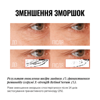 Сироватка з ретиноїдом INSTYTUTUM PRO-GRADE ANTI-AGING X-STRENGTH RETINOL SERUM, 30 мл